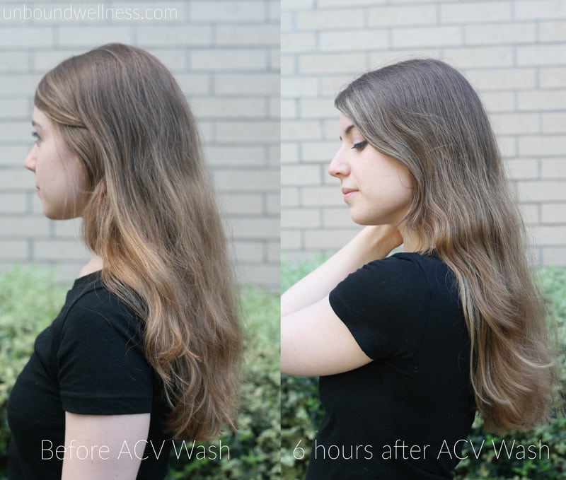 apple cider vinegar before and after hair